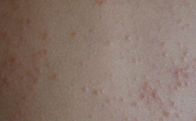 Ƥ�׻�������ߴ�����ЩӰ��