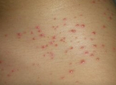 ë���׵�Σ��������Щ