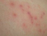 ʪ���������������Σ��