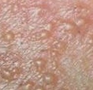 ʪ������ʲôԭ��������ɵ�